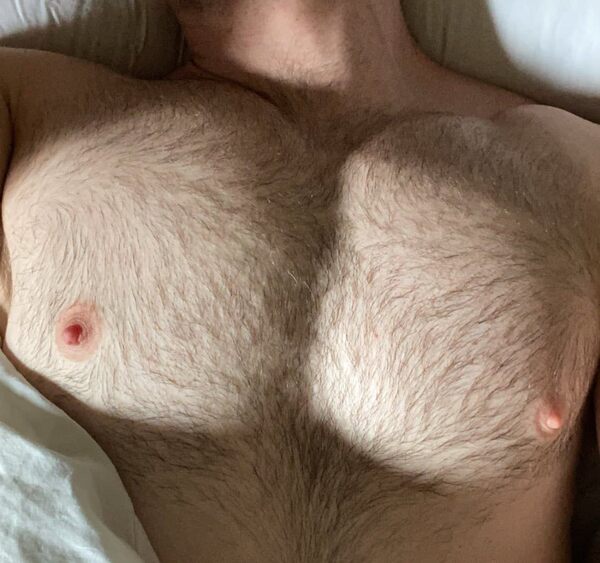 Un-tanned hairy pecs.