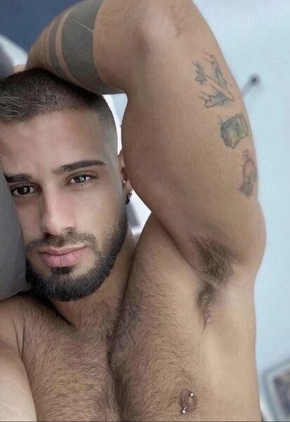 His eyes, nip, and pit all have it…